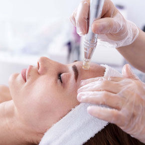 Microneedling Mesotherapie